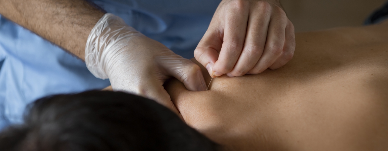 Dry-needling-Smith-Physical-Therapy-&-Wellness-Taft-TX